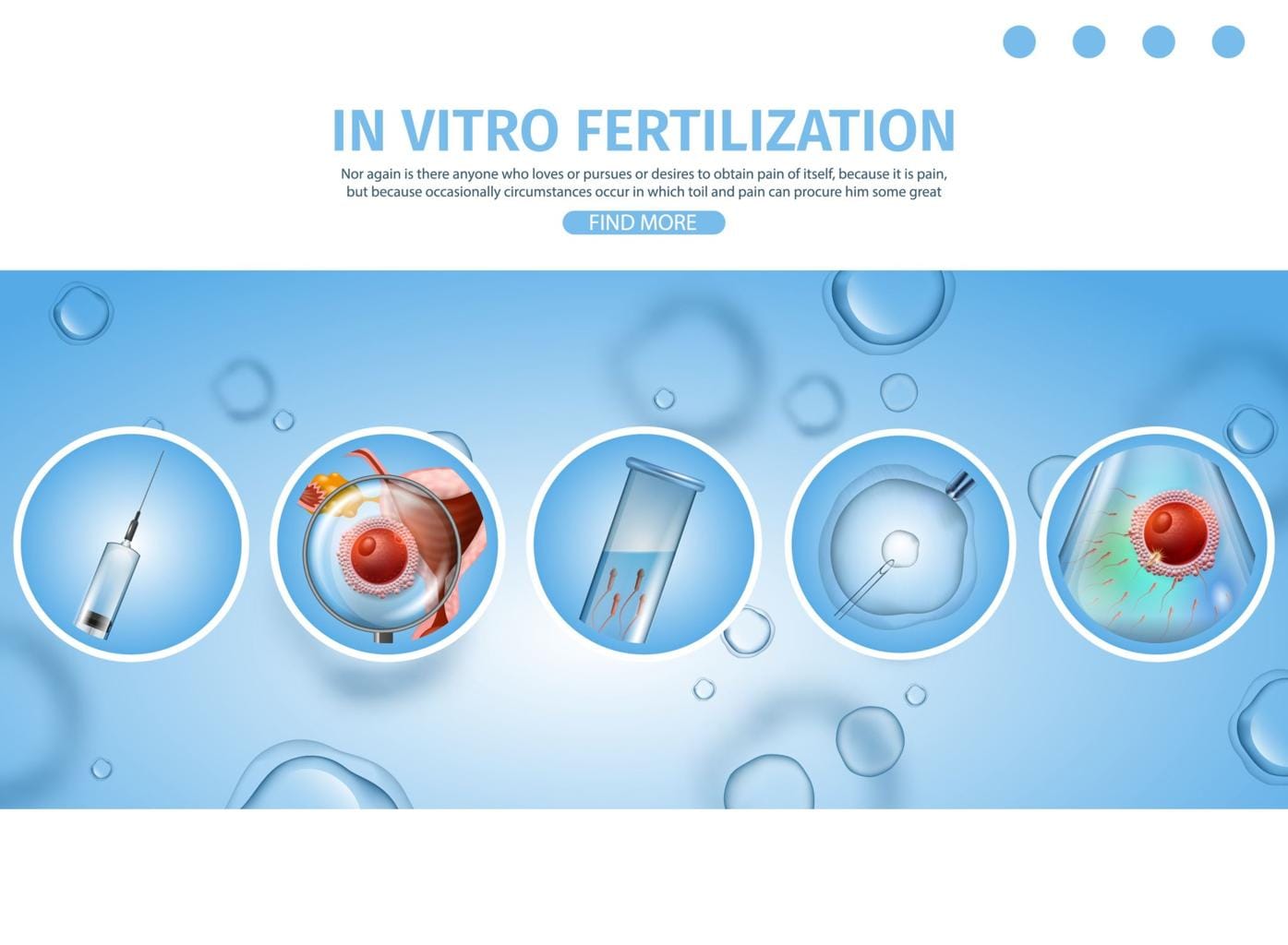 IVF